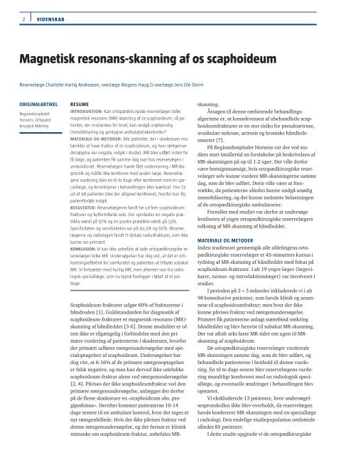 Magnetisk resonans-skanning af os scaphoideum