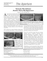 Testicular Microlithiasis: Another Starry Sky Appearance - Clinical ...