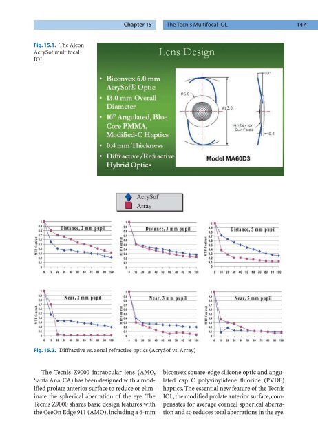 Refractive Lens Surgery