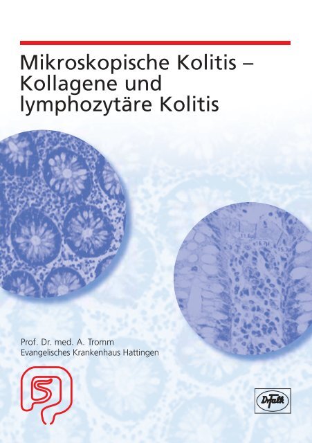 Mikroskopische Kolitis - Dr. Falk Pharma GmbH