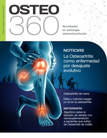 Osteo 360 Número 2, Volumen 1 