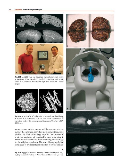 1 Paleoradiology: History and New Developments - Academia.dk