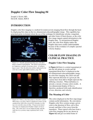 Doppler Color Flow Imaging #4 - Echo in Context