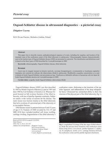 Osgood-Schlatter disease in ultrasound diagnostics – a pictorial essay