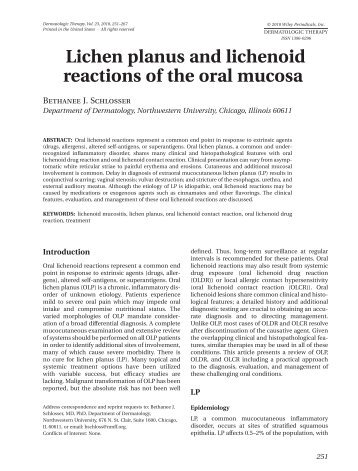 Lichen planus and lichenoid reactions of the oral mucosadth_1322