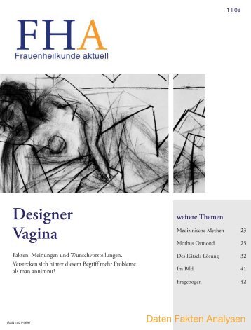 Designer Vagina - Frauenheilkunde aktuell