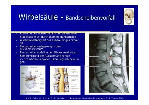 Pause Eis Compression Hochlegen