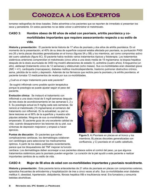 revisión del ipc sobre la psoriasis - International Psoriasis Council