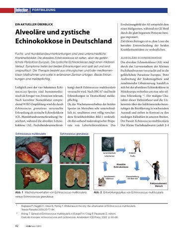 Alveoläre und zystische Echinokokkose in Deutschland - HIV & More