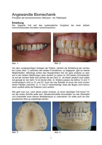 Angewandte Biomechanik - Prinzipien der ... - BSI Zahntechnik