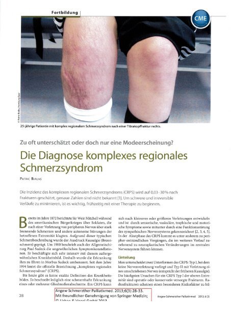 Die Diagnose komplexes regionales Schmerzsyndrom