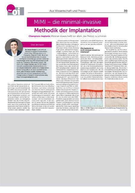 MIMI – die minimal-invasive Methodik der Implantation – ein Fachartikel, erschienen in der Ausgabe 01/2021 der Oralen Implantation