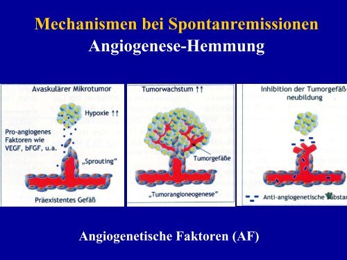 Kappauf, Spontanremissionen bei krebserkrankungen (4 ... - LSF Graz