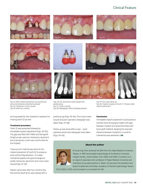 Dental Asia July/August 2021