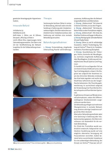 3+1 - Kerr Dental