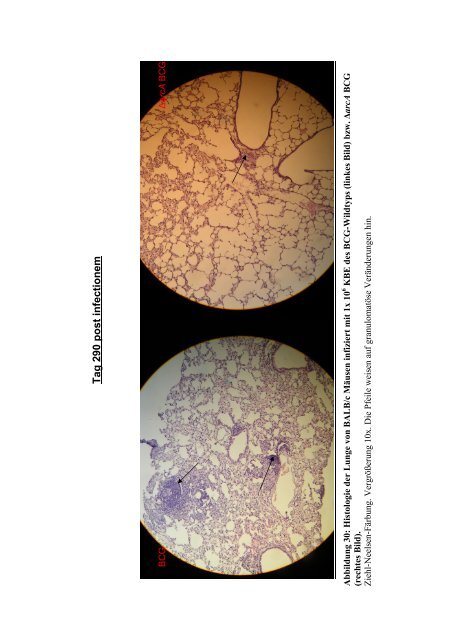 Untersuchungen zum Argininstoffwechsel bei Mycobacterium bovis ...