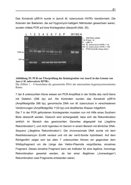 Untersuchungen zum Argininstoffwechsel bei Mycobacterium bovis ...