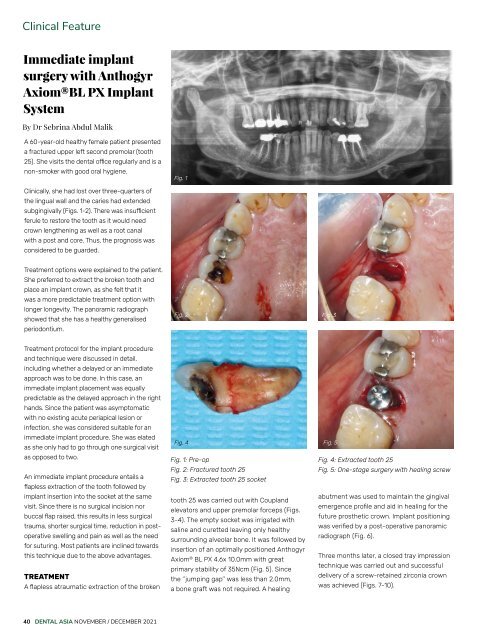 Dental Asia November/December 2021