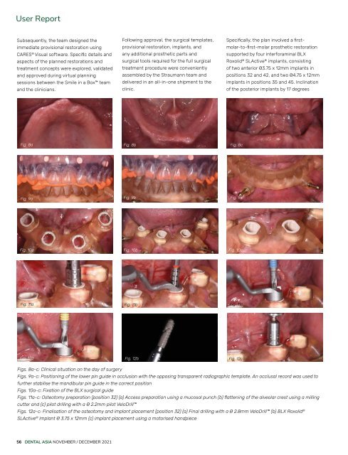 Dental Asia November/December 2021