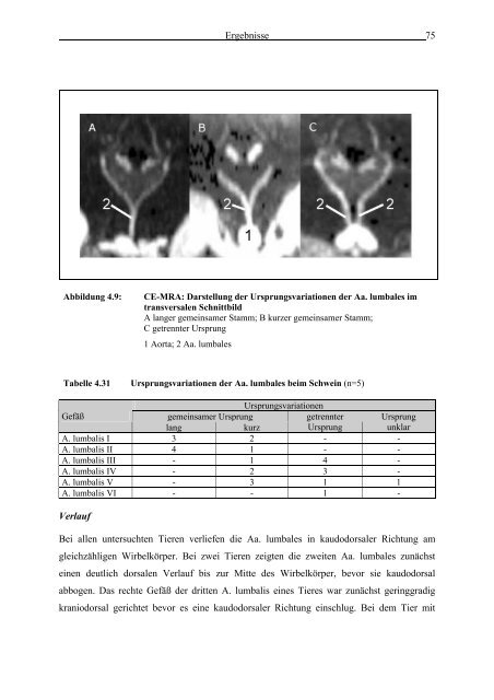 Morphometrie und Gefäßdarstellung der porcinen Lendenwirbelsäule