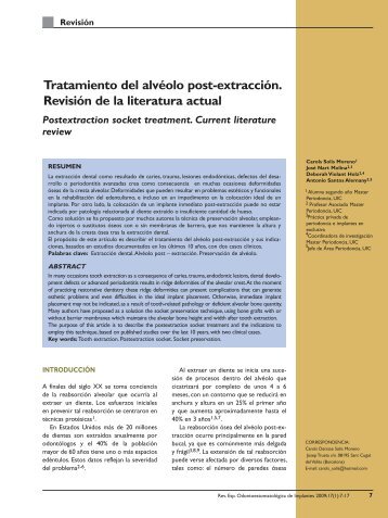 Tratamiento del alvéolo post-extracción. Revisión de la ... - José Nart