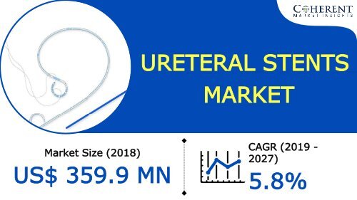 Ureteral Stents Market To Surpass US$ 564.4 Million By 2026