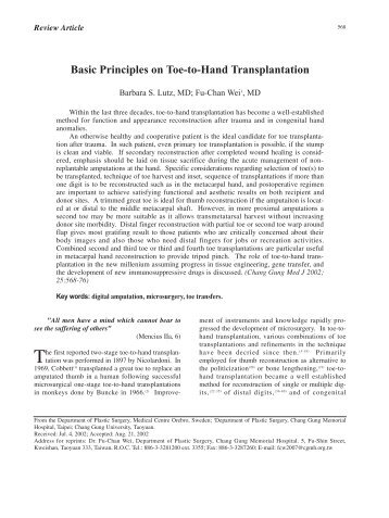Basic Principles on Toe-to-Hand Transplantation