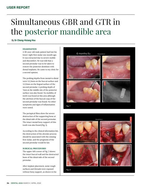 Dental Asia March/April 2022