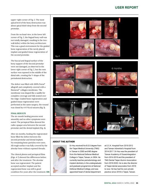 Dental Asia March/April 2022