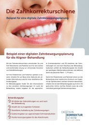 Die Zahnkorrekturschiene - Beispiel digitale Zahnbewegungsplanung