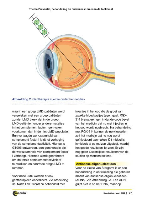 MaculaVisie 1 2022