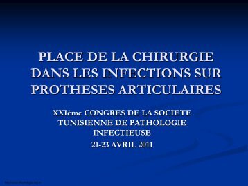 infection - Société Tunisienne de Pathologie Infectieuse