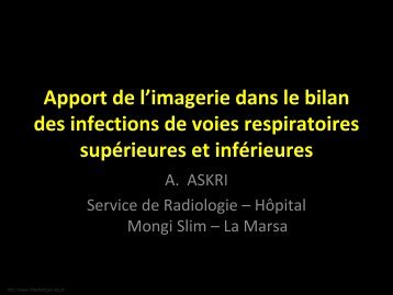 Apport de l'imagerie dans le bilan des infections de voies ...