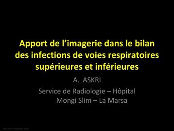 Apport de l'imagerie dans le bilan des infections de voies ...