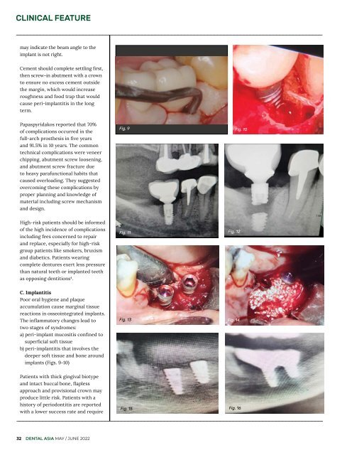 Dental Asia May/June 2022