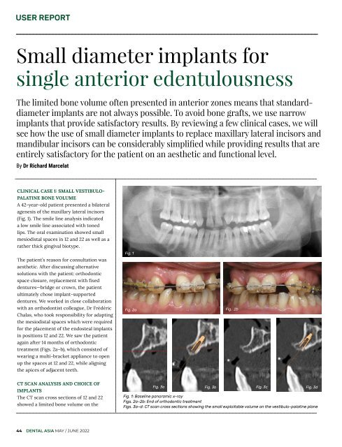 Dental Asia May/June 2022