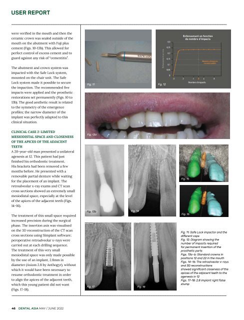 Dental Asia May/June 2022