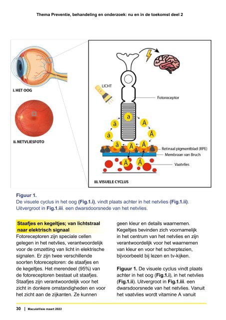 MaculaVisie 2 2022