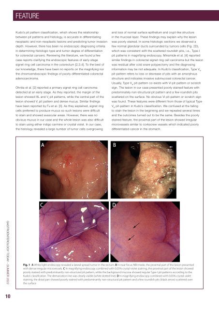 Gastroenterology Today Summer 2022