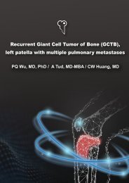 Patella Gct with Lung Mets