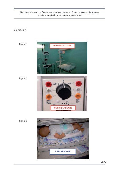 Raccomandazioni per l'assistenza al neonato con encefalopatia