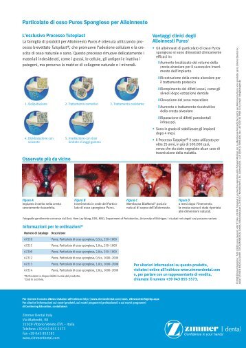 Particolato di osso spongioso per Alloinnesto Puros - Zimmer Dental