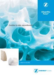 Le procédé Tutoplast - Zimmer Dental