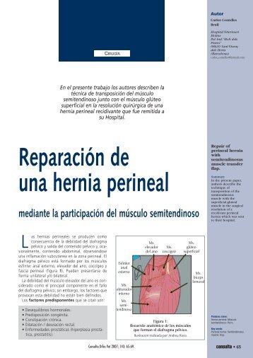 CONSULTA_143_65-69