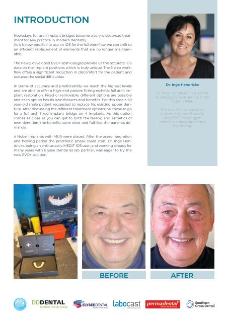 Casereport Evo plus Inge Hendrickx (NL)