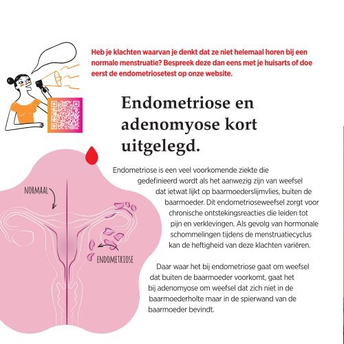 Informatie folder Endometriose