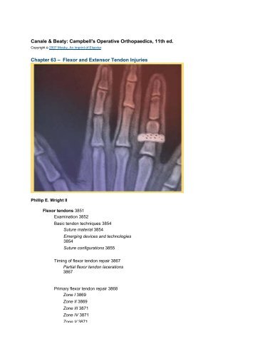 Canale & Beaty: Campbell's Operative Orthopaedics, 11th ed ...