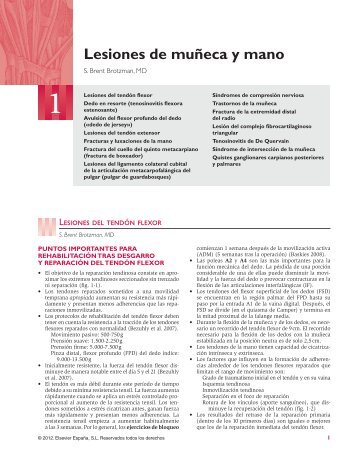 Lesiones de muñeca y mano - Axon