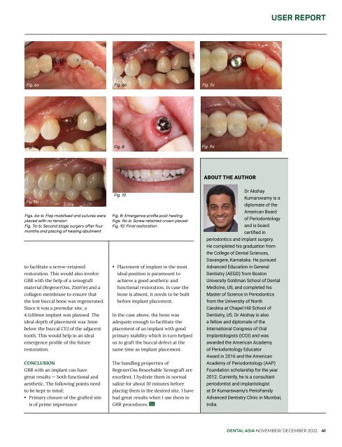 Dental Asia November/December 2022