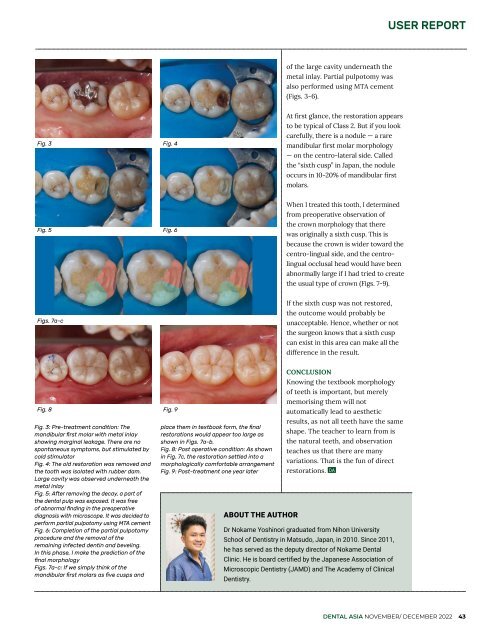 Dental Asia November/December 2022